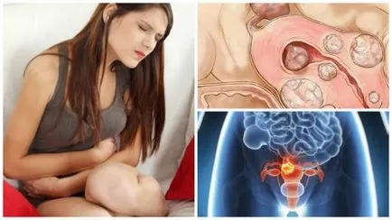 Îndepărtarea părului în zona profundă a bikini sau nu dăunătoare pentru sănătatea etapa (zona) Îndepărtarea părului în zona profundă a bikini sau nu dăunătoare pentru sănătatea etapa