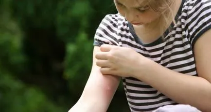 înțepături de țânțar în tratamentul copiilor, cum pentru a determina cât de periculos, cum de a trata (culori luminoase parfumuri aromate) înțepături de țânțar în tratamentul copiilor, cum pentru a determina cât de periculos, cum să trateze