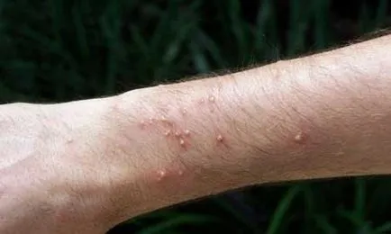 musca furnică