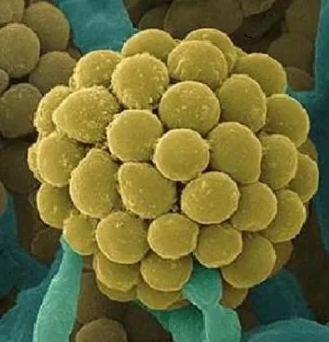 specie fungică prin metoda de aprovizionare (simbioză) specie fungică prin metoda puterii