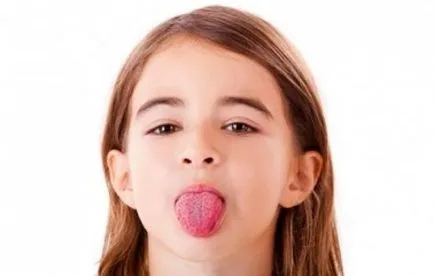 Scarlatina este tratat, simptomele, primele simptome, prognosticul, fie (tratament) poate Scarlatina este tratat, simptomele, primele simptome, prognosticul, indiferent dacă
