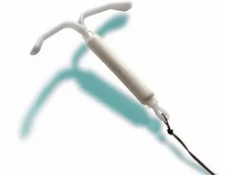 DIU - contracepție pentru femei nulipare