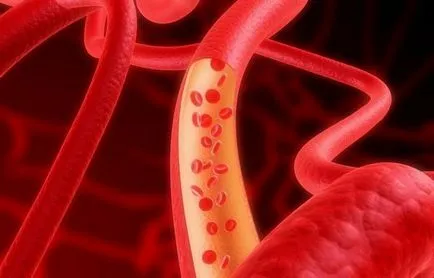 Recuperarea de la leziuni spinarii, boala si chirurgie (dupa) Recuperarea de la leziuni ale coloanei vertebrale, boli și operații