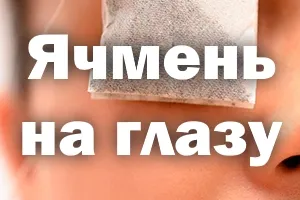 Stye cum se vindeca rapid la domiciliu, tratamentul la domiciliu, cura (orz) Stye cum se vindeca rapid la domiciliu, tratament la domiciliu, vindeca