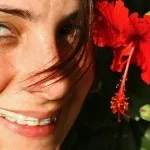 De ce igienizarea profesională a dinților la dentist