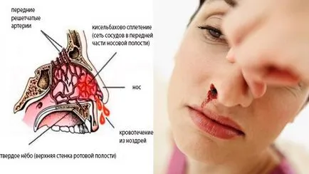 Gore motiv nas de ce se coace în dimineața (nas) Gore motiv nas de ce se coace în dimineața