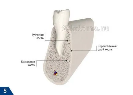 Implanturile bazale - Comentarii argumente pro și contra, prețul pentru 2017