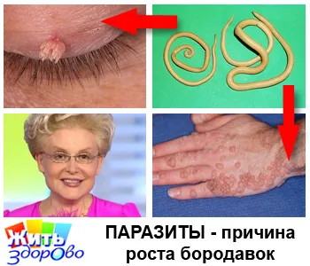 Ce se poate face în cazul în care diagnosticat cu „astigmatism“ la copii (pot să apară astigmatism) Ce se poate face în cazul în care diagnosticat cu „astigmatism“ la copii