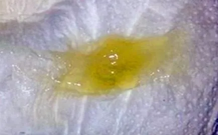 Ce culoarea sputei