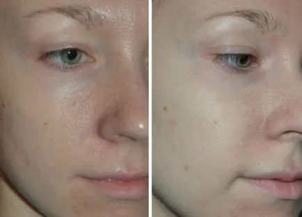 Ce este o mască de alge și cum se folosește acest cosmetologie inovare (ca masca alginat aplicată) Ce este o mască de alge și cum se folosește acest cosmetologie inovație