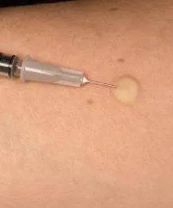 Diaskintest comentarii