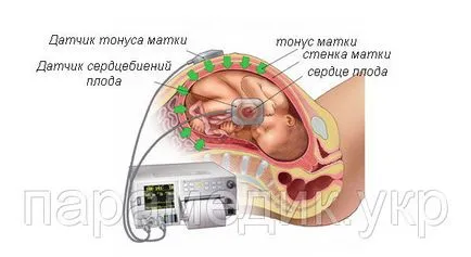 Doppler fetal - acesta este modul de a utiliza (utilizarea adecvată a Doppler) Doppler fetal - acesta este modul în care să folosească în mod corespunzător