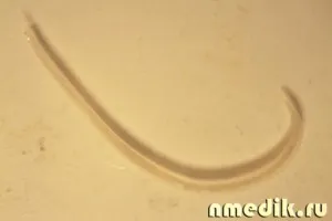 Worms (helminths) - simptome și medicație împotriva paraziților