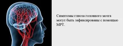 creier gliosis ce este, prognosticul de viață și alegerea tratamentului (a creierului) creier gliosis opțiuni ce este, prognosticul de viață și de tratament