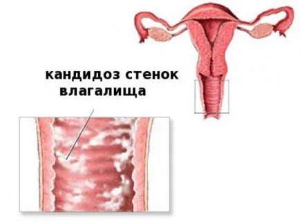 Lista bolilor ginecologice din cele mai comune (comune) Lista bolilor ginecologice dintre cele mai frecvente