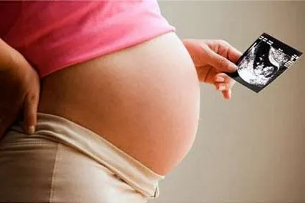 Maturitate placenta 0, 1, 2, 3; maturitate de săptămâni (ca sarcină) Maturitate placenta 0, 1, 2, 3; gradul de maturitate săptămână