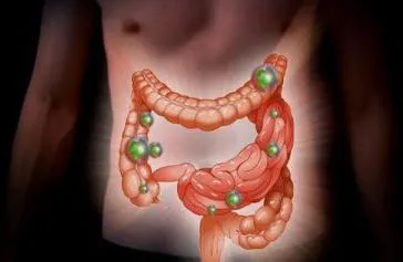 Ce și cum să ia antibiotice pentru o infectie intestinala (intestinale) Ce și cum să ia antibiotice pentru o infectie intestinala