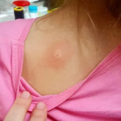 Cum sa scapi de albine în peretele casei, să le scot din casa de lemn