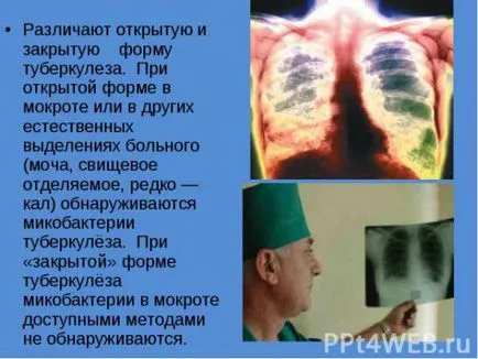 Cum de a trata tuberculoza pulmonară în căile de atac acasă populare, medicină, rețete, adulți (acasă) Cum de a trata tuberculoza pulmonară în căile de atac acasă populare, medicina, rețete adulți