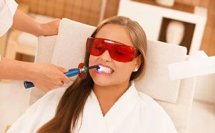 Dinții albi în curs de examinare dentară a metodelor (albire dentară) Cum de a albi dintii in metode de revizuire dentare