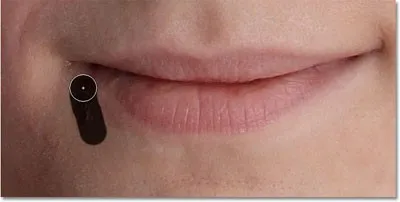 Cum de a elimina petele de piele