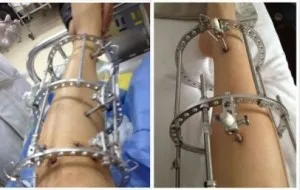 Cum să se lungească picioarele toate metodele disponibile ale lungirea picioarelor (exerciții) Cum să se lungească picioarele toate metodele disponibile ale picioarelor lungirea