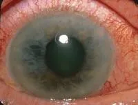 Cum de a vedea lumea din jurul daltonism (colorblind) Cum de a vedea lumea din jurul colorblind