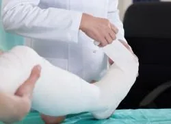 Este posibil să calce pe piciorul în ghips
