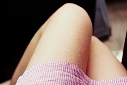 Goosebumps - cauzele simptomelor, metode de tratament