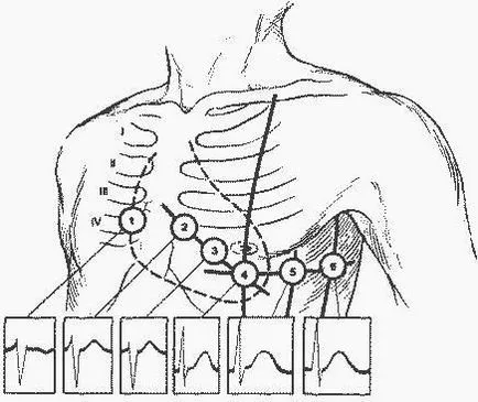 Tehnologia de electrocardiograma - studopediya (Manuale) Tehnologia de electrocardiografie - studopediya
