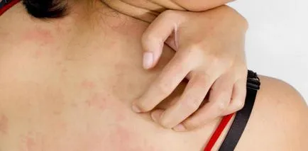 De ce este zgâriat din spate ne aflăm împreună (înapoi) De ce ne aflăm din nou împreună mancarimilor