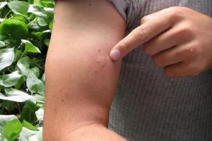 De ce zboară musca în luna august (vara târzie) și toamna (de ce) De ce zboară musca în luna august (vara târzie) și toamna