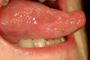 Limba ei - dureri de a face