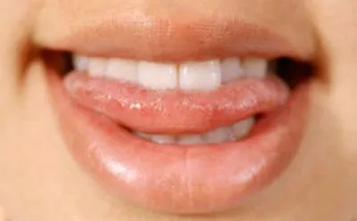Bite semnul meu limba