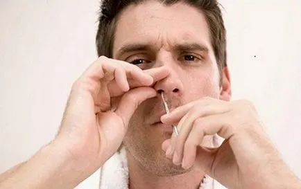 Îndepărtarea părului în nas - ce si cum, cosmetologie hardware