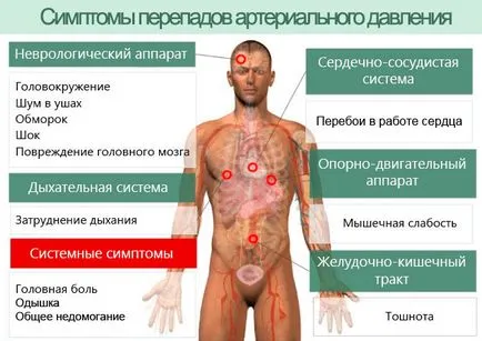 presiune Rides (mai mare, mai mici), motivele care fac (presiune) Rides de presiune din motive (de exemplu, mare, atunci scăzut) care fac