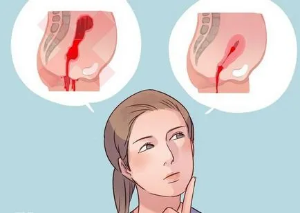 Cât de mult sânge iese la rata lunară, o mulțime de mică sângerare (menstruației) Cât de mult sânge iese la rata lunară, o mulțime, o mică sângerare