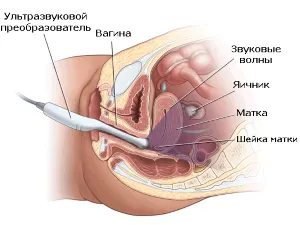 Tabel ritmului cardiac fetal de săptămâni de gestație (palpitații) Tabelul cardiac fetal de săptămâna sarcinii