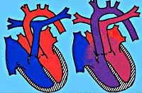 Transpunerea vaselor mari - cauze, simptome, diagnostic și tratament