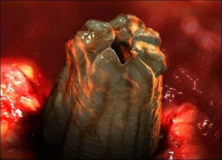 Toxocarioza simptomelor câini și apariția parazit (Toxocarioza) Toxocarioza simptomelor câini și apariția parazit