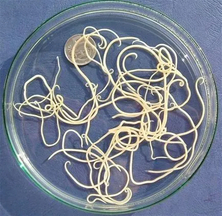Toxocarioza simptomelor câini și apariția parazitului (simptome) Toxocarioza simptomelor câini și apariția parazit