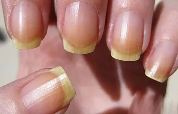 Nociv în caz de unghii cu gel de unghii - efecte dăunătoare compoziției nocive pentru utilizarea sa constantă (unghii) Nociv în cazul în gel lac de unghii - efecte adverse asupra compoziției ca fiind nocive pentru utilizarea sa constantă