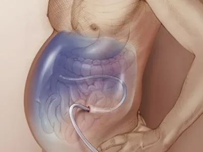 Hirurgiya- Centrul Medical 