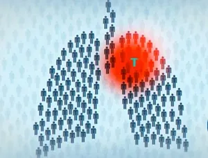 туберкульоз відкрита форма передається способи передачі інфікування