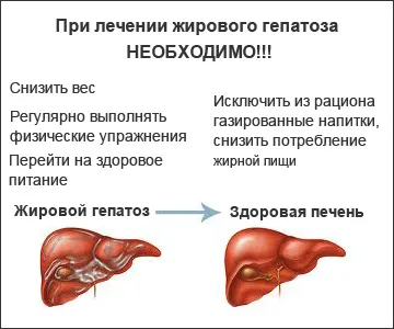 як лікувати гепатоз печінки в домашніх умовах