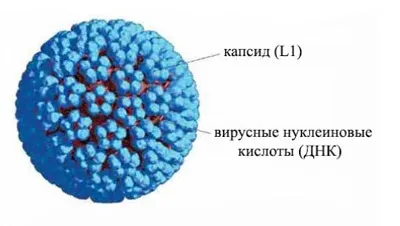 як лікувати папіломи гортані