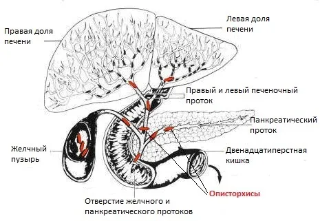 як лікувати опісторхоз більтріцідом