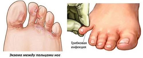 профілактика