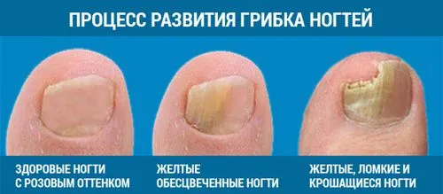 профілактика
