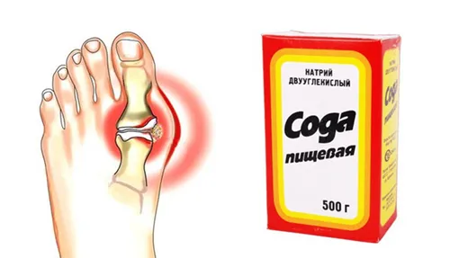 лікувати суглоби содою